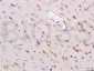 HSP70 Rabbit pAb